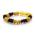 Yellow and black Baltic amber roundel children's bracelet, 15cm